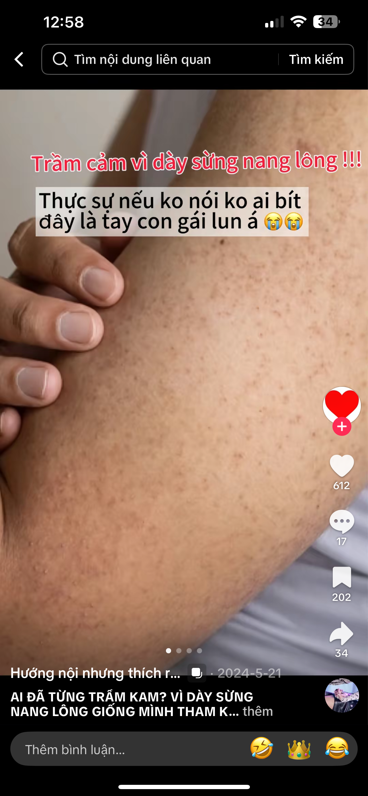340530-4f417781aec0.png
