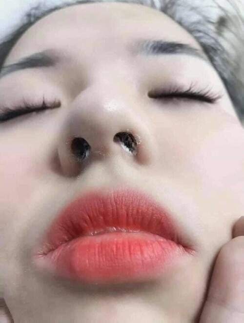399292-d9c7b7156573.jpeg