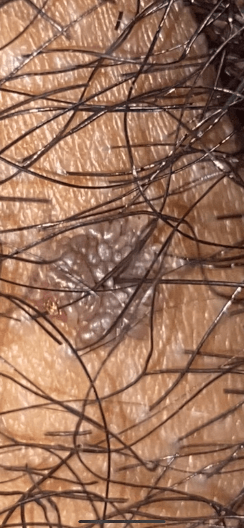 464577-c052af628f0b.png