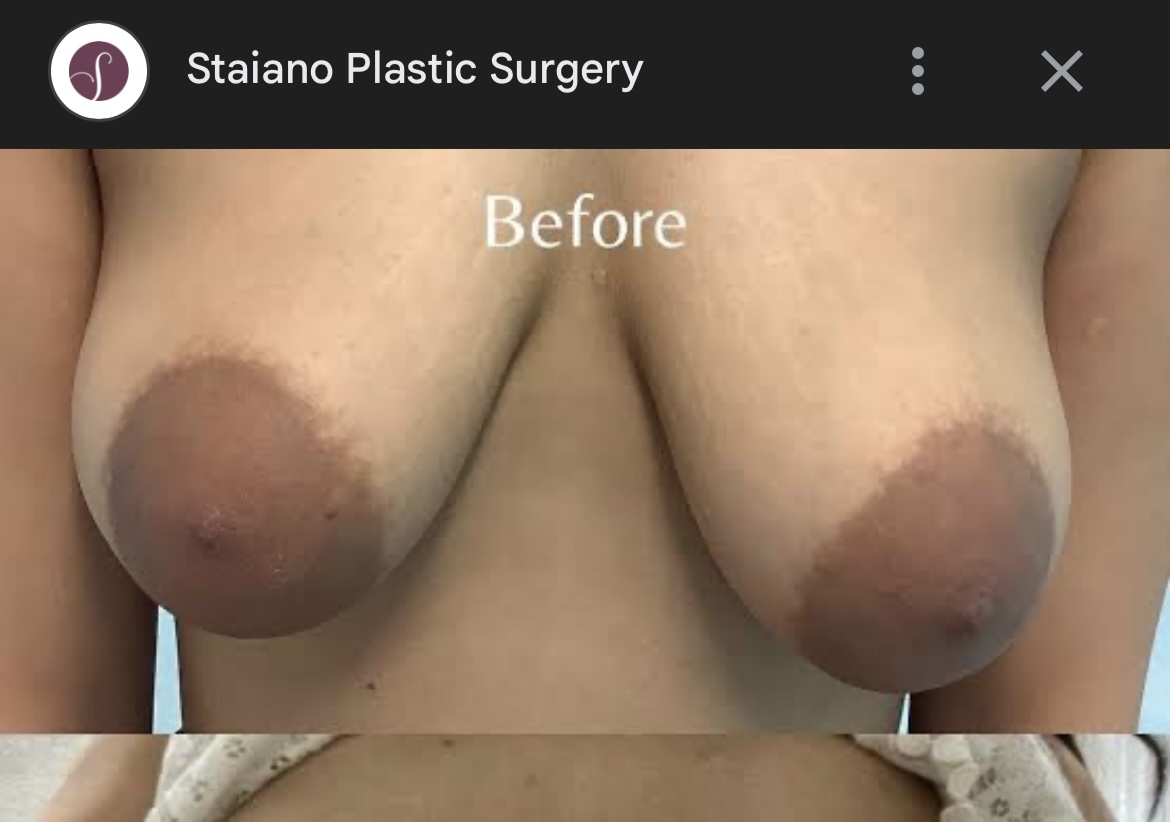 524386-2433af6f6441.jpeg