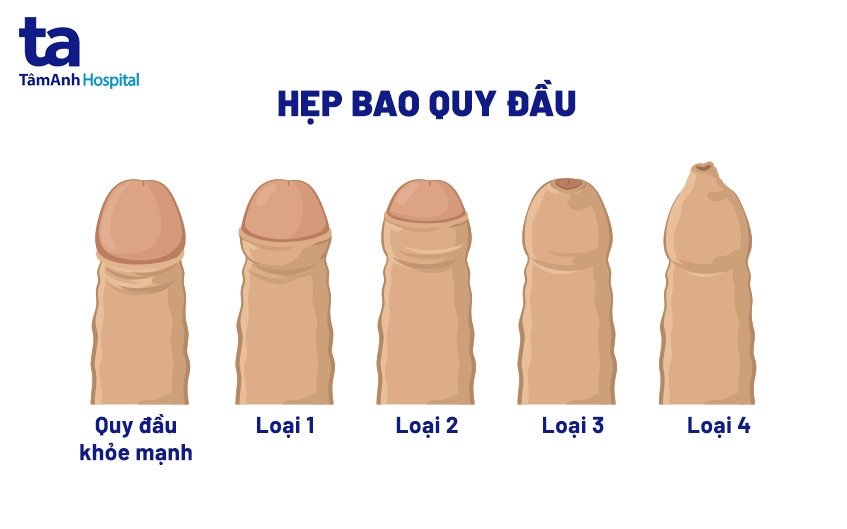 631447-c181437fcacb.png