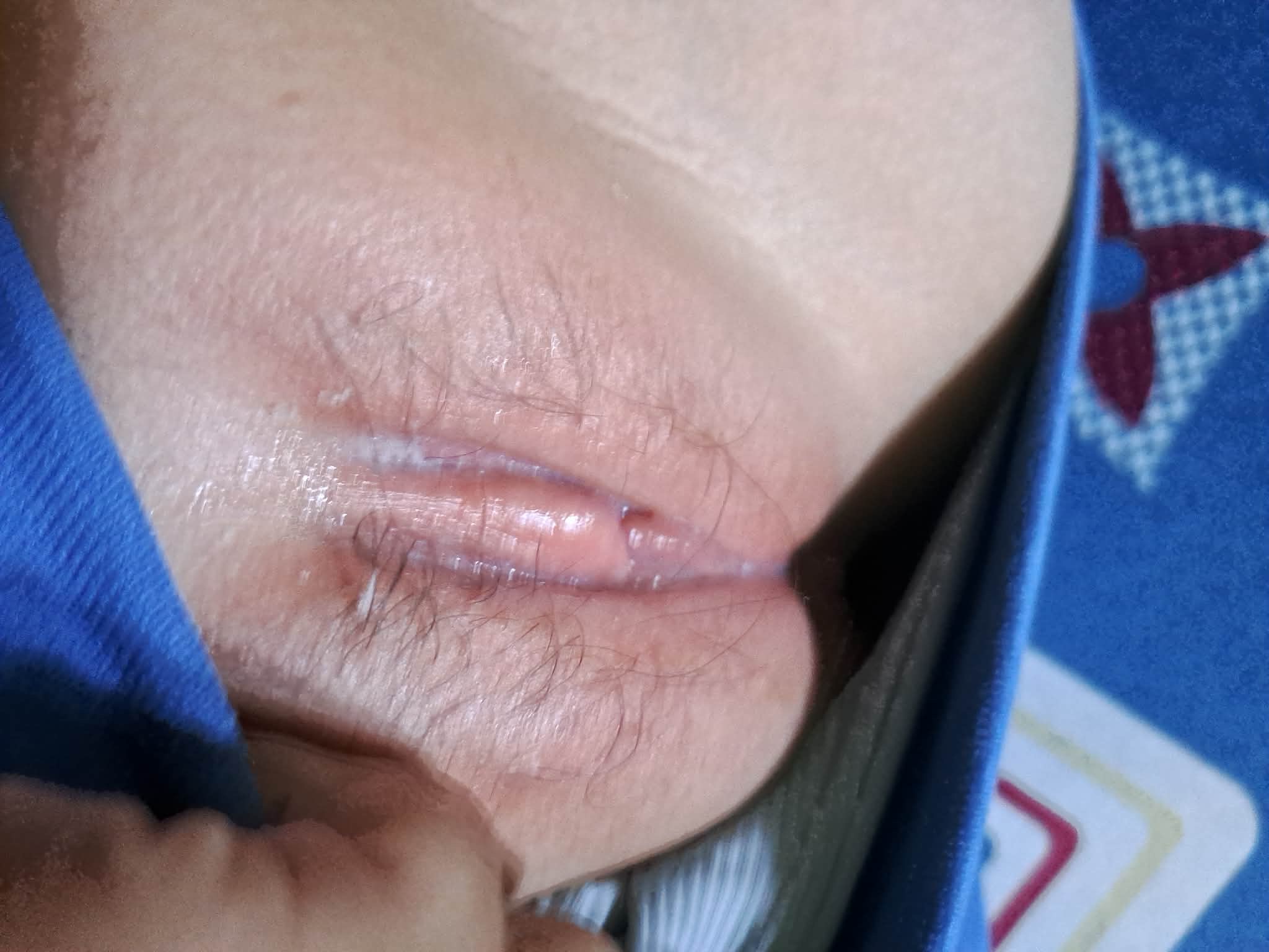 683041-fa5957933900.jpeg